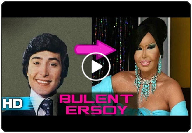 Cinsiyet Değiştiren 5 Ünlü