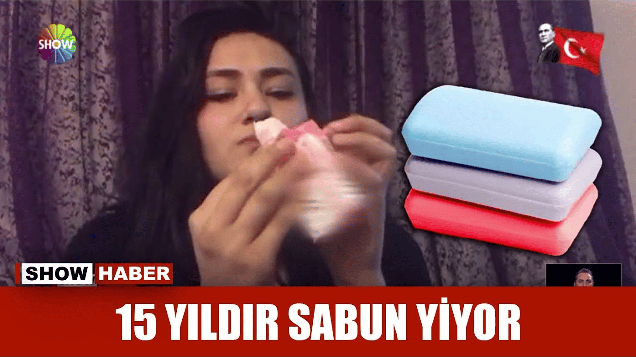 Böyle hastalık görülmedi. Yıllardır sabun yiyen kadın görenleri şaşırttı.!